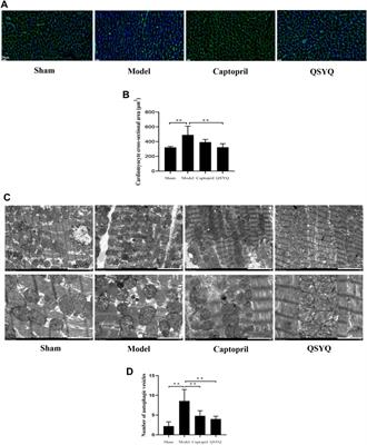 QishenYiqi dripping pill protects against myocardial ischemia/reperfusion injury via suppressing excessive autophagy and NLRP3 inflammasome based on network pharmacology and experimental pharmacology